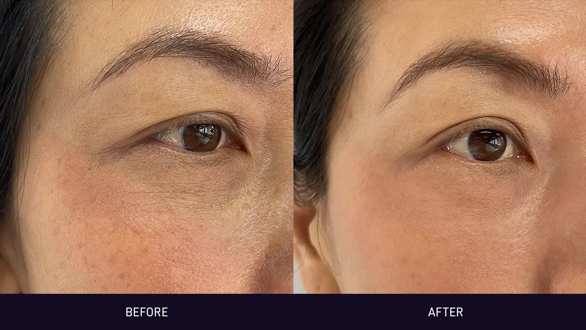 FAQ 502 before and after